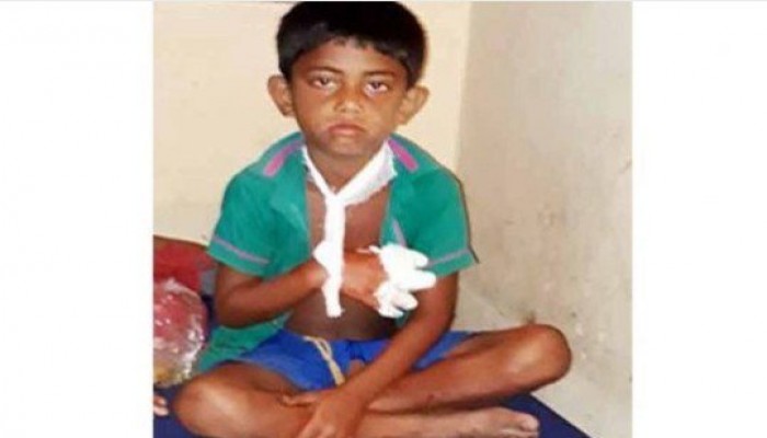 মাথায় তুলে পরপর তিন আছাড়, তারপর কেটে ফেলে শিশুটির তিন আঙুল